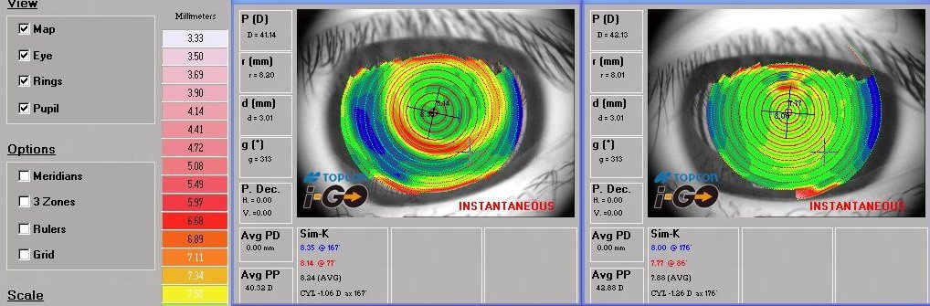 Hi-tech and Customised Analysis